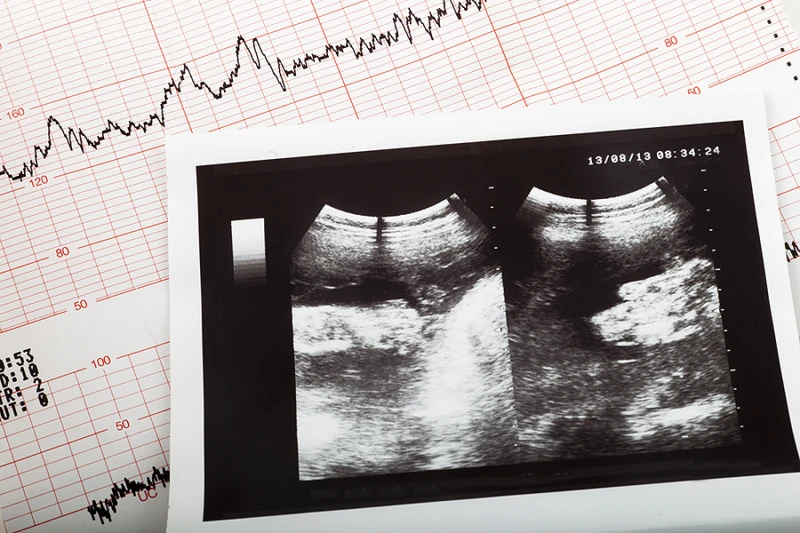 Trump administration appeals to some pro-life reproductive health care despite IVF push