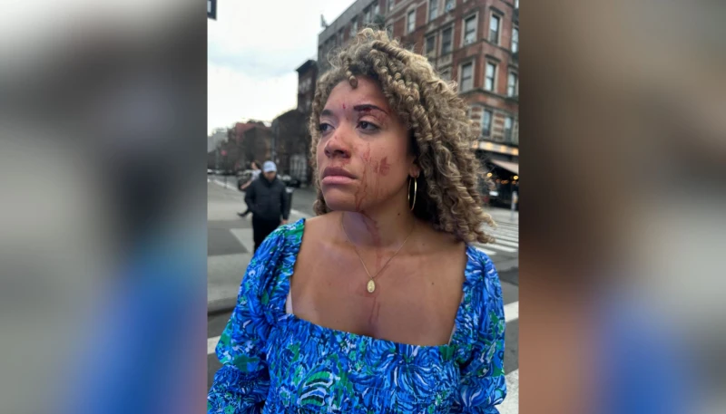 New York prosecutor drops charges against suspect in bloody assault on pro-life advocate